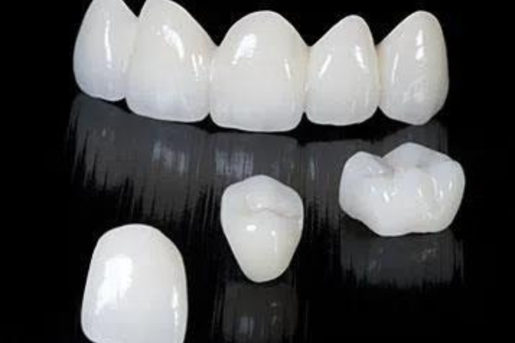 Tooth Crown And Bridges Treatment